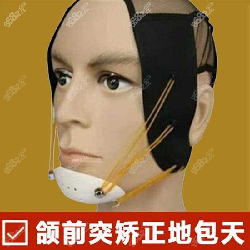 地包天矫正 正文上颌斜面导板矫治器适用于不良习惯导致的反颌(地包天
