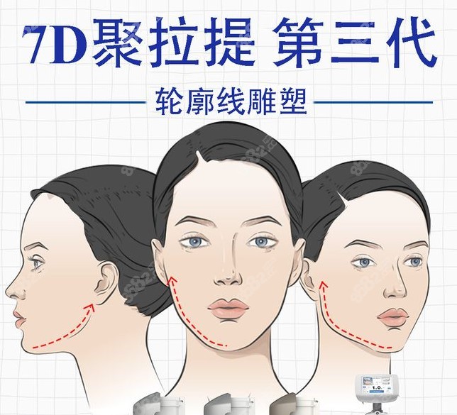 据说7d聚拉提的效果比热玛吉更好?那维持的时间会更久吗?