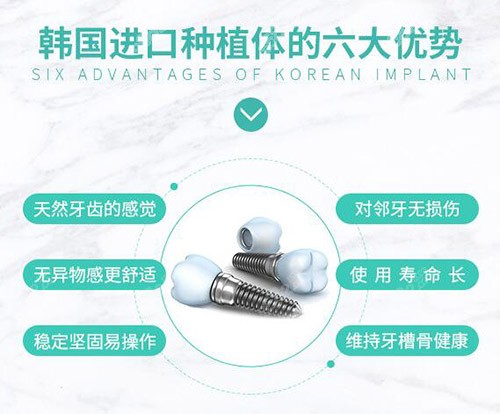 种牙21年降价吗 公布21年种植牙价格表 收费详情揭秘 86赴韩整形网