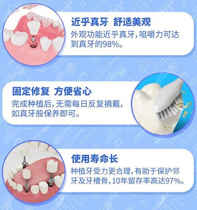 种牙21年降价吗 公布21年种植牙价格表 收费详情揭秘 86赴韩整形网