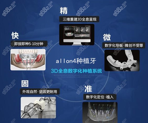 杭州全口種植牙的價格是多少錢?列如allon4滿口種植的費用