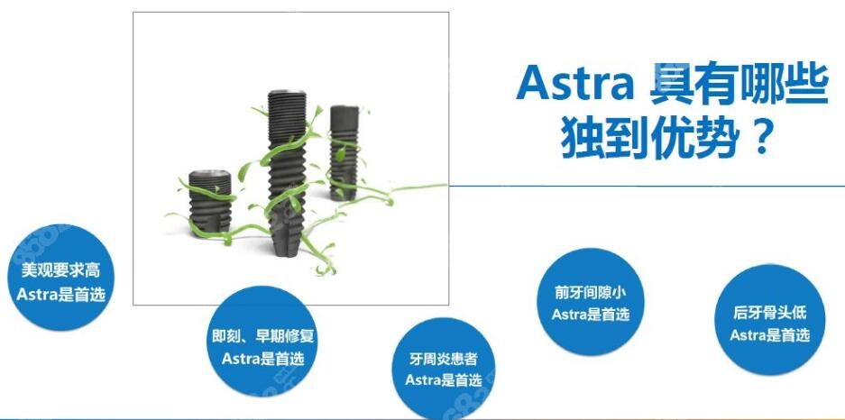 瑞典astra種植體和諾貝爾哪個好,這有astra種植牙的優缺點