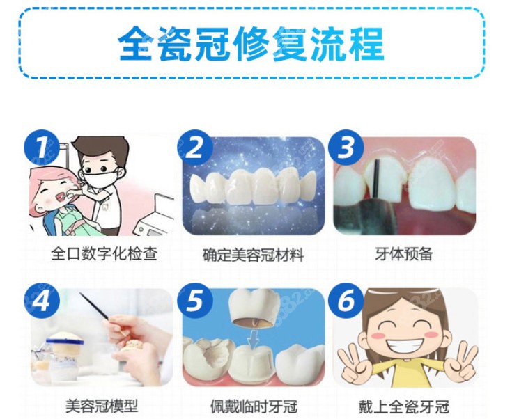 烤瓷牙制作过程图片